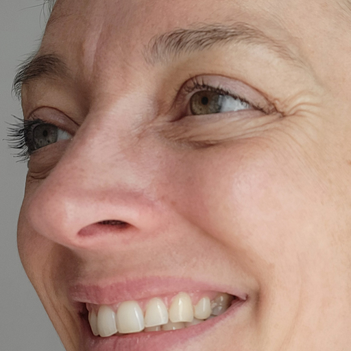 Photo montrant la réduction des rides de Morgane M après la prise du collagène de Oslo Skin Lab