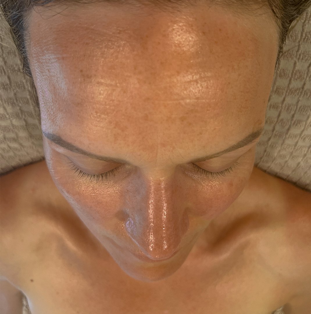 Photo Après d’une femme ayant pris The Solution, la poudre de collagène d’Oslo Skin Lab. Elle s’appelle Jayne.