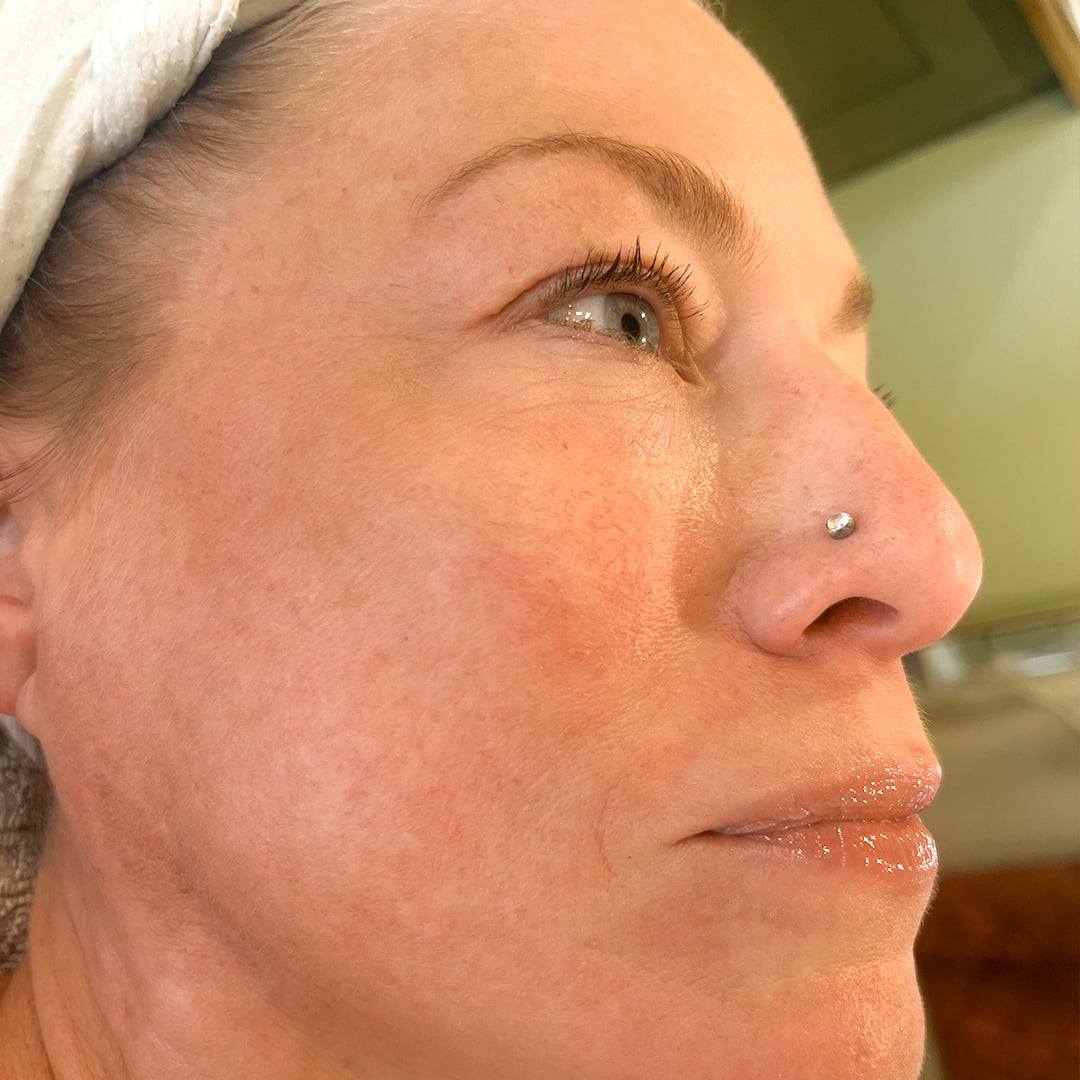 Photo Après d’une femme ayant pris The Solution, la poudre de collagène d’Oslo Skin Lab. Elle s’appelle Amanda.