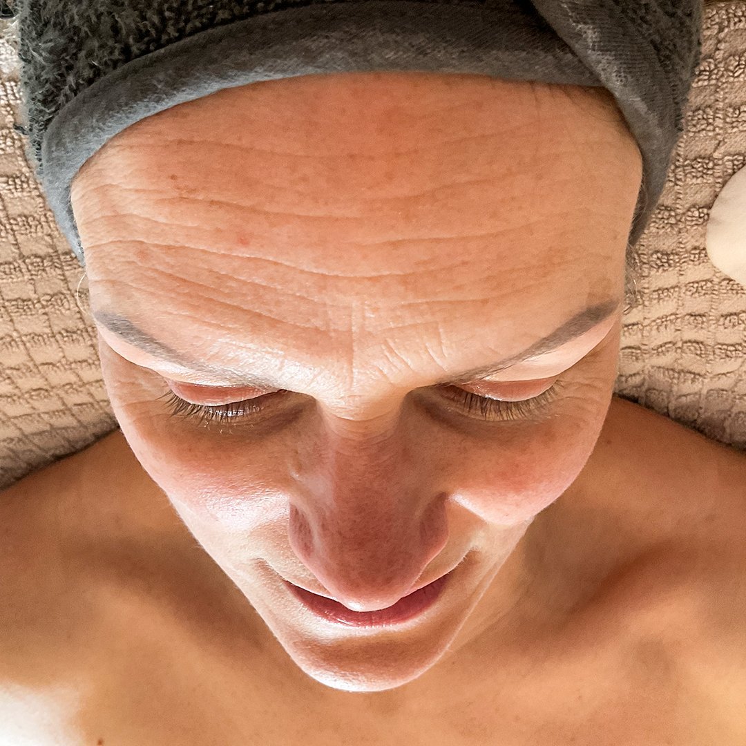 Photo d'une femme Avant d'avoir pris The Solution, la poudre de collagène d’Oslo Skin Lab. Elle s’appelle Jayne.