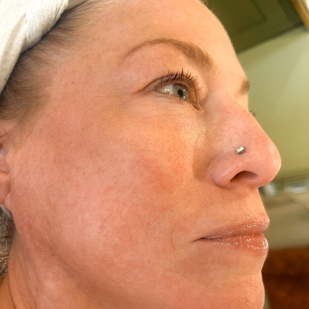 Photo Après d’une femme ayant pris The Solution, la poudre de collagène d’Oslo Skin Lab. Elle s’appelle Amanda.