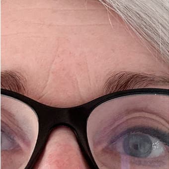 Photo Après d’une femme ayant pris The Solution, la poudre de collagène d’Oslo Skin Lab. Elle s’appelle Brit.