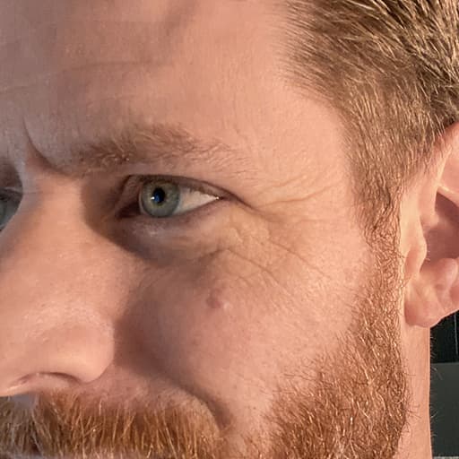 Photo Après d’un homme ayant pris The Solution, la poudre de collagène d’Oslo Skin Lab. Il s’appelle Jesse.