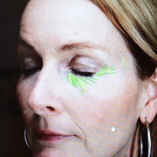Photo d'une femme avant de commencer à prendre The Solution, la poudre de collagène d’Oslo Skin Lab. Elle s’appelle Heidi.