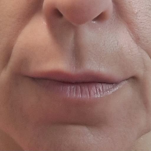 Photo d’une femme avant d'avoir pris The Solution, la poudre de collagène d’Oslo Skin Lab. Elle s’appelle Priscilia.
