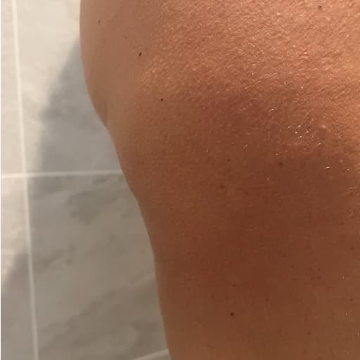 Photo d'une femme Après avoir pris The Solution, la poudre de collagène d’Oslo Skin Lab. Elle s’appelle Tonje.
