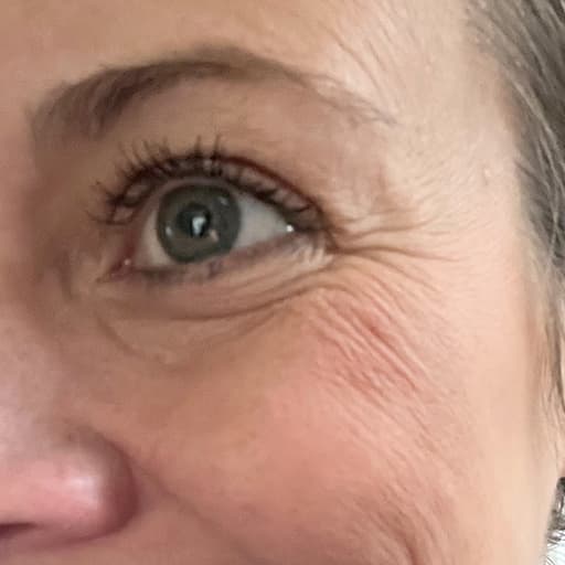 Photo d'une femme avant de commencer à prendre The Solution, la poudre de collagène d’Oslo Skin Lab. Elle s’appelle Melissa.