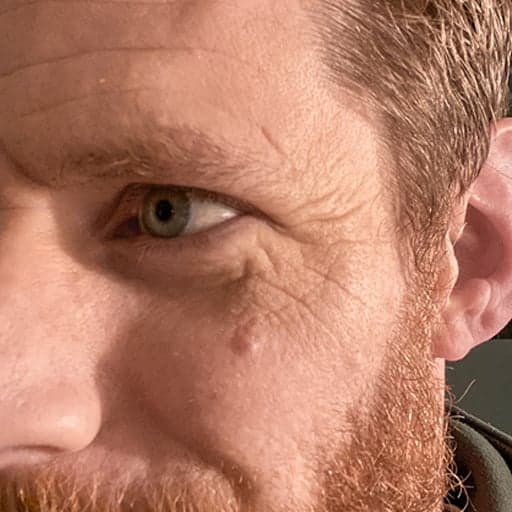 Photo d'un homme avant de commencer à prendre The Solution, la poudre de collagène d’Oslo Skin Lab. Il s’appelle Jesse