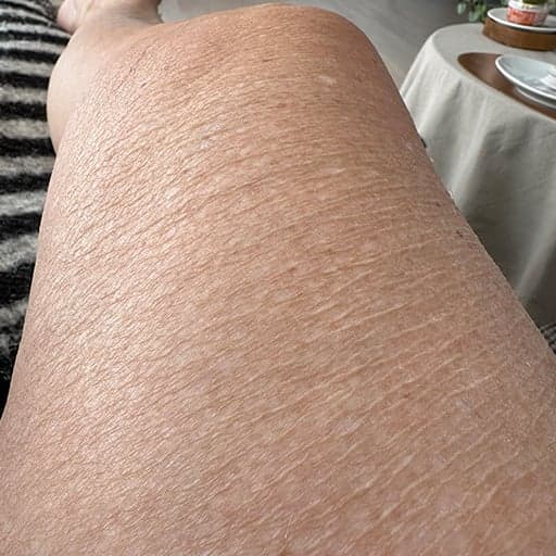 Photo d'une femme avant de commencer à prendre The Solution, la poudre de collagène d’Oslo Skin Lab. Elle s’appelle Jette