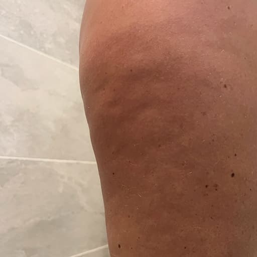 Photo d'une femme Avant d'avoir pris The Solution, la poudre de collagène d’Oslo Skin Lab. Elle s’appelle Tonjie.