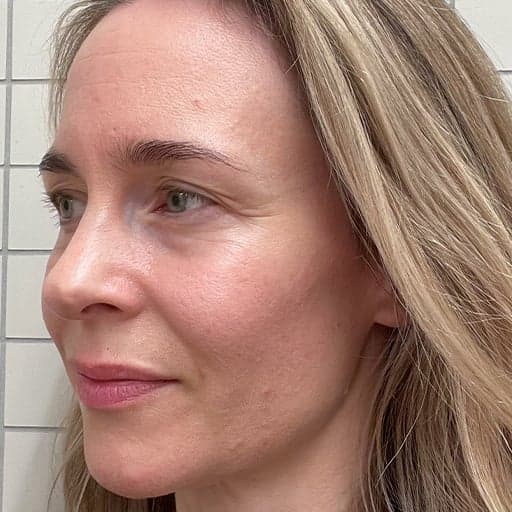 Photo Après d’une femme ayant pris The Solution, la poudre de collagène d’Oslo Skin Lab. Elle s’appelle Charlotte.
