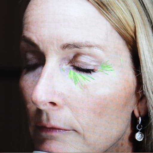 Photo Après d’une femme ayant pris The Solution, la poudre de collagène d’Oslo Skin Lab. Elle s’appelle Heidi.