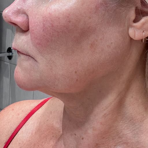 Photo Après d’une femme ayant pris The Solution, la poudre de collagène d’Oslo Skin Lab. Elle s’appelle Helen.