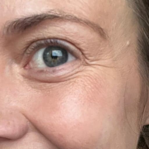 Photo Après d’une femme ayant pris The Solution, la poudre de collagène d’Oslo Skin Lab. Elle s’appelle Melissa.