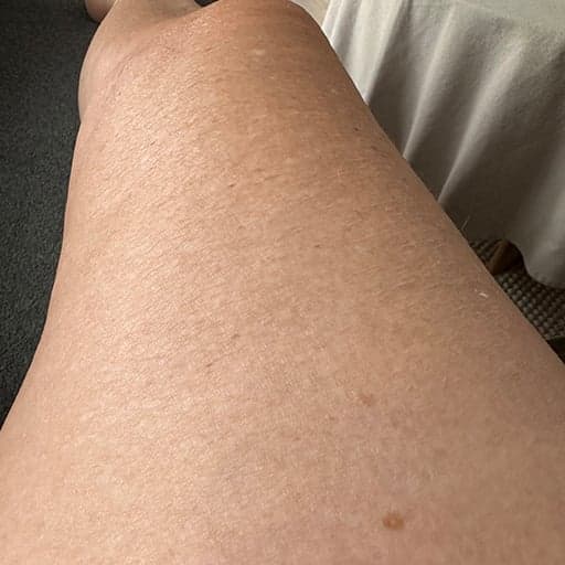 Photo Après d’une femme ayant pris The Solution Beauty Collagen, la poudre de collagène d’Oslo Skin Lab. Elle s’appelle Jette.