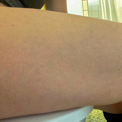 Photo Après d’une femme ayant pris The Solution, la poudre de collagène d’Oslo Skin Lab. Elle s’appelle Nadia.