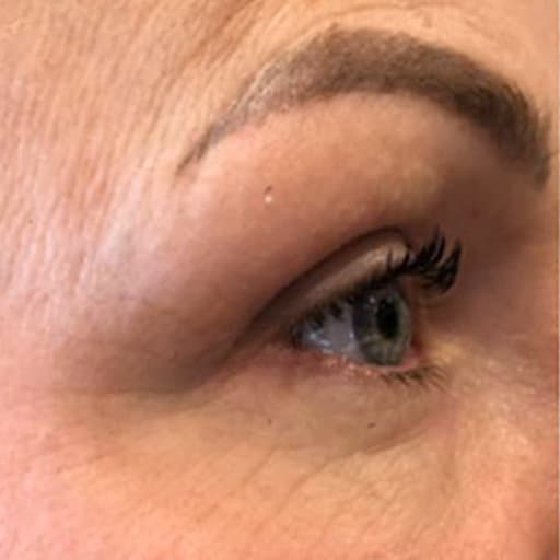 Photo Avant d'une femme ayant de commencer à prendre The Solution, la poudre de collagène d’Oslo Skin Lab.  Elle s’appelle Michelle.