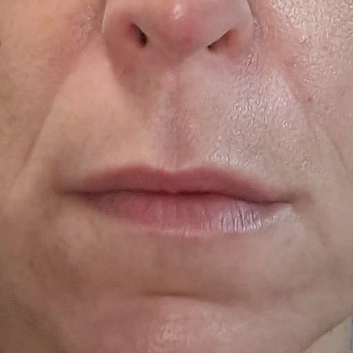 Photo Après d’une femme ayant pris The Solution, la poudre de collagène d’Oslo Skin Lab. Elle s’appelle Priscilia