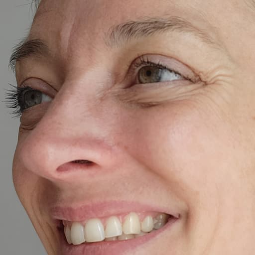 Photo montrant la réduction des rides de Morgane M après la prise du collagène de Oslo Skin Lab
