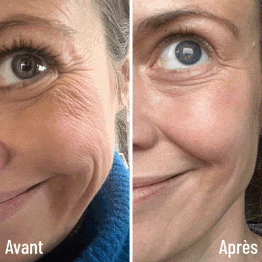 Gif animé présentant les avant/après des clients The Solution